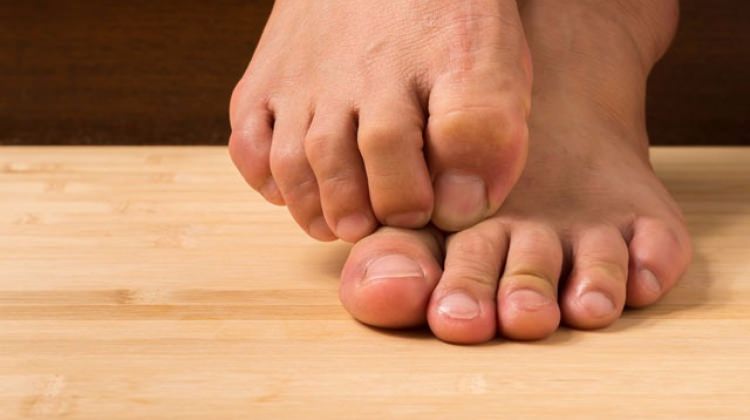 Ayak mantarı tedavisi