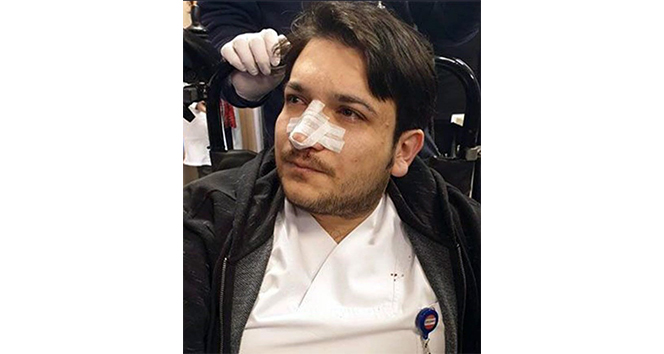 Randevusuz muayene olmak istedi, doktorun burnunu kırdı