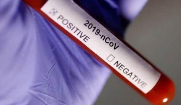 Bu kadarına pes! ‘Koronavirüsün ilacı var’ deyip dolandırdı