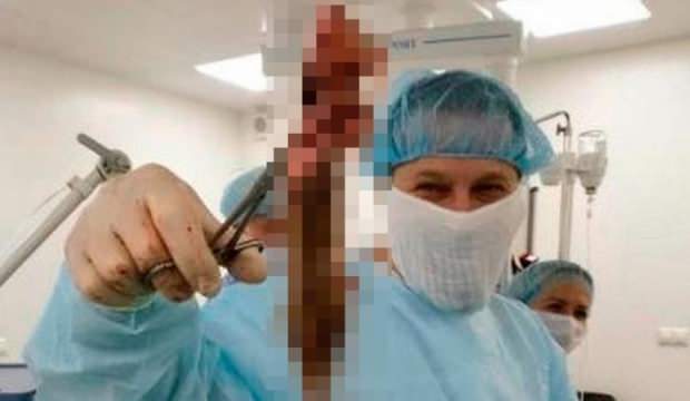 Haftalarca karın ağrısıyla gezdi! Çıkana doktorlar bile şaşırdı