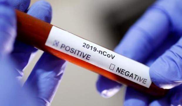 Sağlık Bakanlığından koronavirüsten korunmaya yönelik bilgi notu