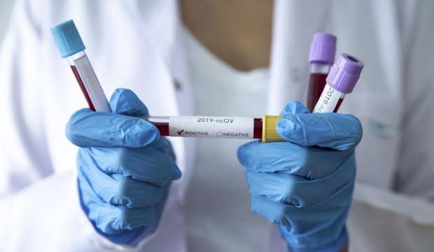 Dikkat! Sağlık Bakanlığı’ndan son dakika koronavirüs açıklaması!