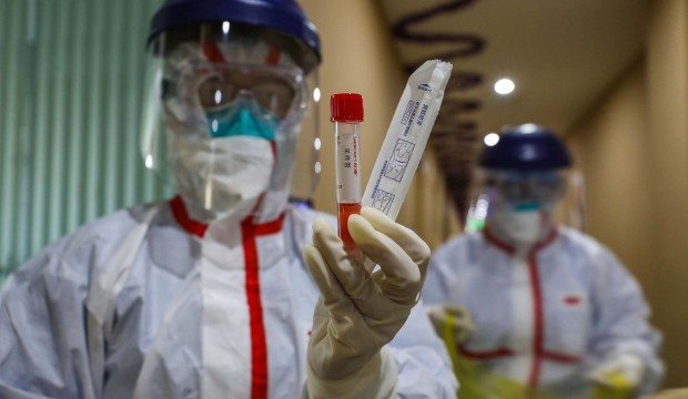 Türkiye’de ilk kez görüldü: Koronavirüs nedir, koronavirüsün belirtileri nelerdir?