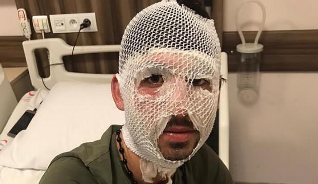 Yunan polisi bunu da yaptı! Kaynar su iddiası…