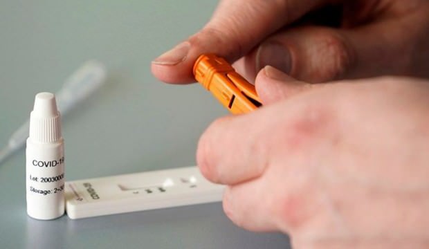 20 dakikada sonuç veren koronavirüs testi! 50 milyon sipariş aldı