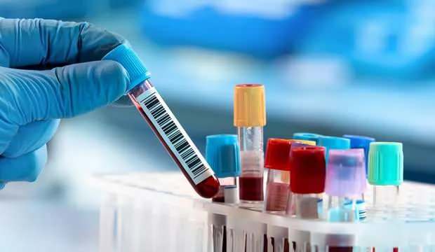 Afrika’da Kovid-19’dan iyileşen hasta sayısı 7 bini aştı