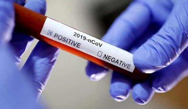 Dünya genelinde Kovid-19’dan ölenlerin sayısı