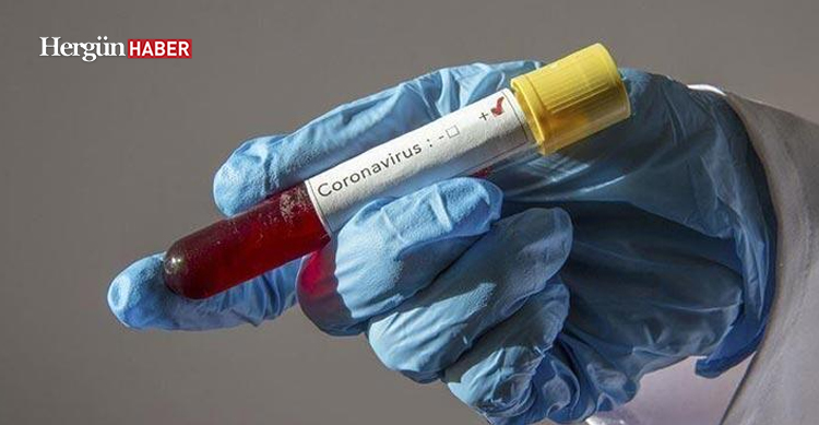 Özel hastanelerde virüs tedavisi için para ödeniyor mu?