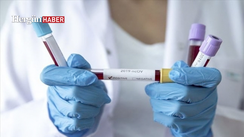 İstanbul için yeni koronavirüs tedbir paketi yayımlandı!