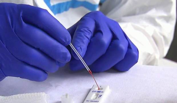 Bilim insanları: Testlerin yüzde 30’u yanlış olabilir