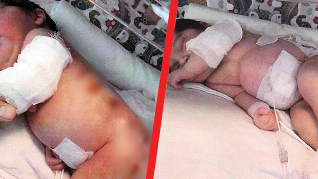 Doğumhanede üzerinde ısıtıcı unutuldu, 18 gün yoğun bakımda kaldı… Karar verildi!