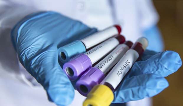 Gaziantep’te bir günde 56 vaka