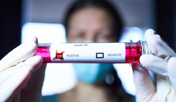 İngiltere, Kovid-19 semptomlarına iki yeni belirti daha ekledi