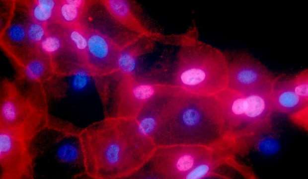 SARS virüsünün sonunu getiren gelişme Kovid-19’da da görüldü