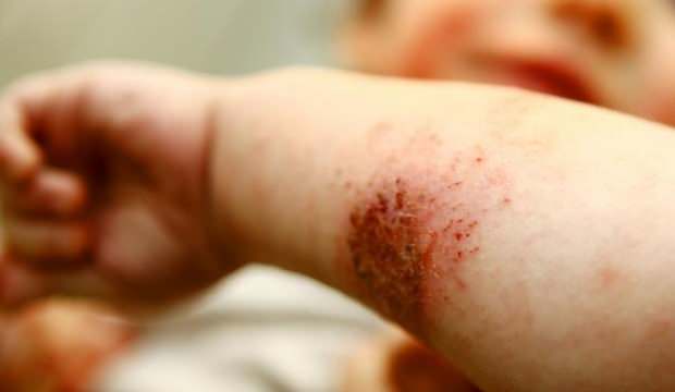 Yeni kabus! Fransa’da ilk can kaybı yaşandı