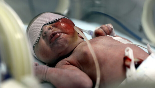 Yürek sızlatan olay! Kağıt toplayan kardeşler çöpte bebek buldu