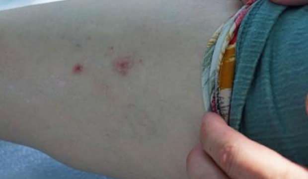 Dirençleri arttı, ilaçlar da fayda etmiyor!