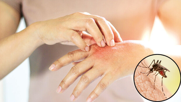 ‘Dirençleri arttı, ilaçlar fayda etmiyor’… Yeni kâbus sivrisinek