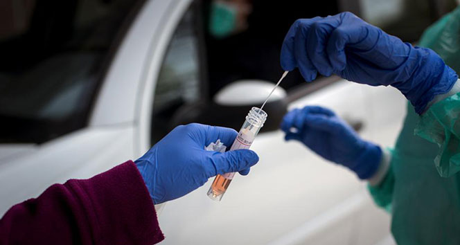 Oxford Üniversitesi, 8 bin kişide denenen Covid-19 aşısının başarılı olduğunu açıkladı