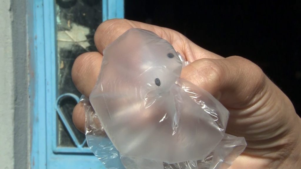 İstanbul’da bir binayı yüzlerce kene istila etti